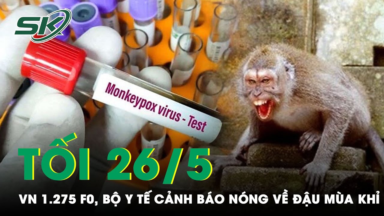 Tối 26/5: Thêm 1.275 Ca Covid-19, Bộ Y Tế Cảnh Báo Người Nghi Mắc Đậu Mùa Khỉ Cần Tự Cách Ly | SKĐS